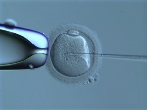 Icsi inyección intracitoplasmática