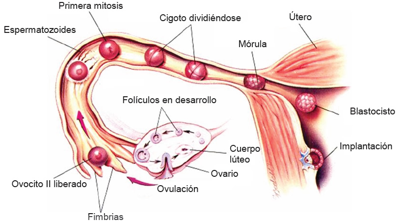 Fallo de implantación recurrente