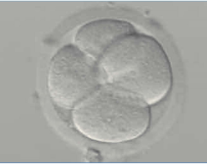 Embrión de 4 células (tipo A en día+2)