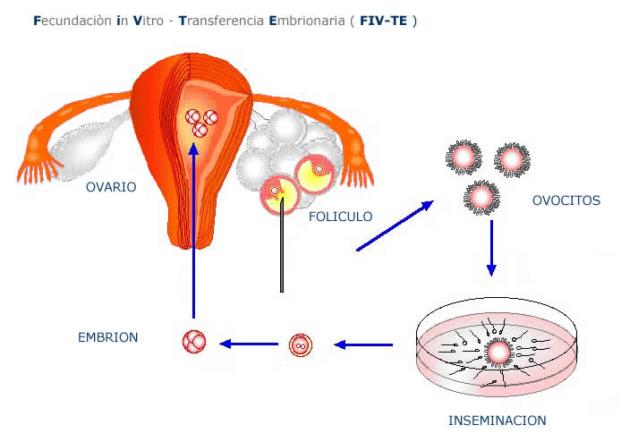 Transferencia embrionaria