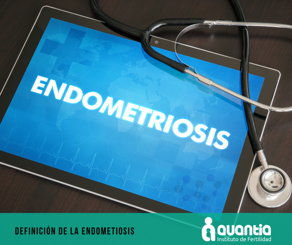 Definición de la endometriosis