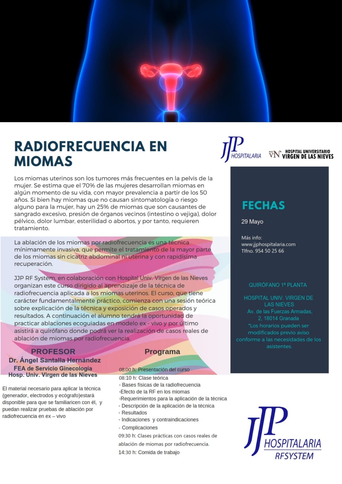 Radiofrecuencia en Miomas